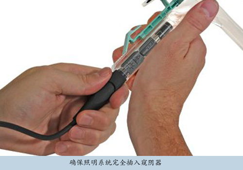 美國(guó)偉倫一次性帶電纜窺陰器照明系統(tǒng)78810及其變壓器配件詳解